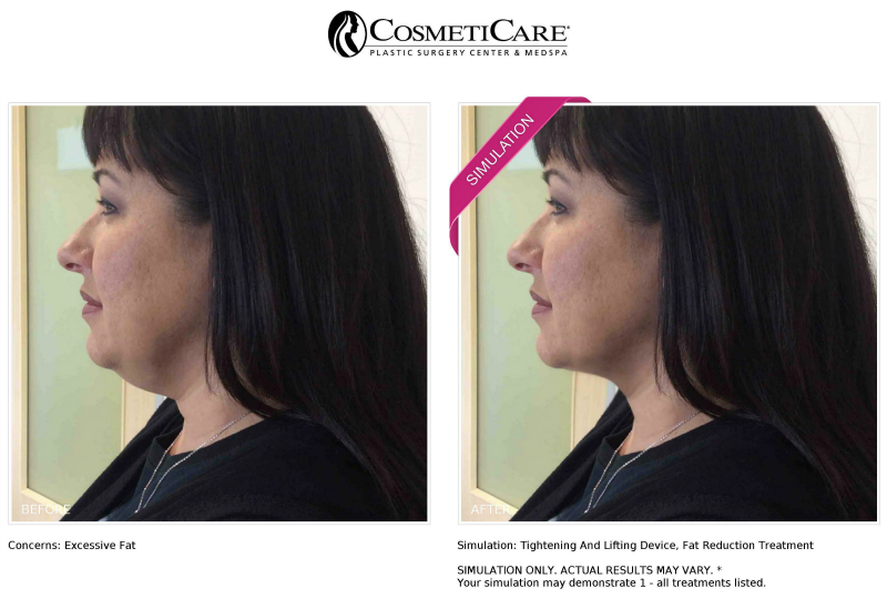 Cosmeticare New Look Now Simulation Results