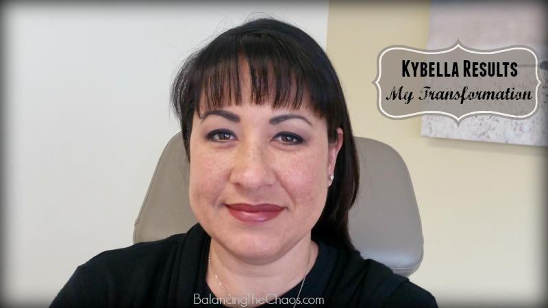 Cosmeticare Kybella Results My Transformation