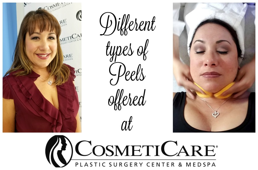 Different Types of Peels offered at CosmetiCare