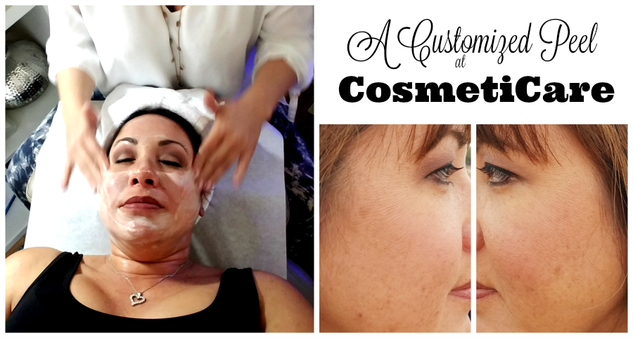 A Customized Peel at CosmetiCare