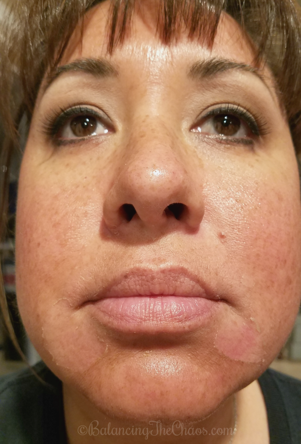 BalancingTheChaos Customized Vitality Peel with CosmetiCare