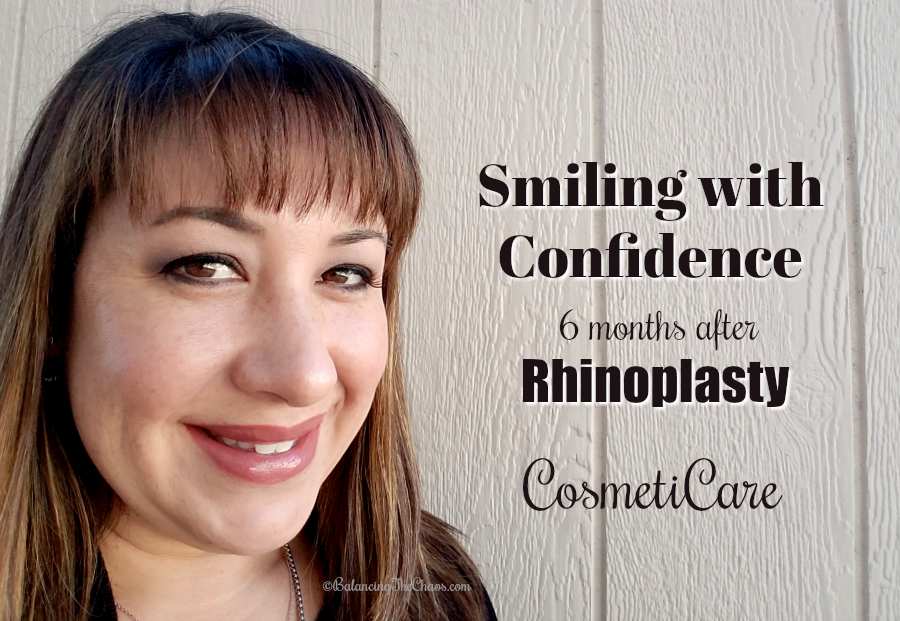 Rhinoplasty with CosmetiCare Newport Beach 6 months results