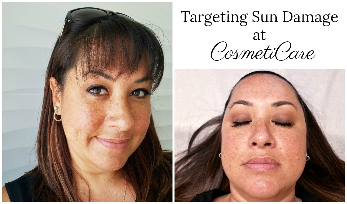 Targeting Sun Damange at CosmetiCare